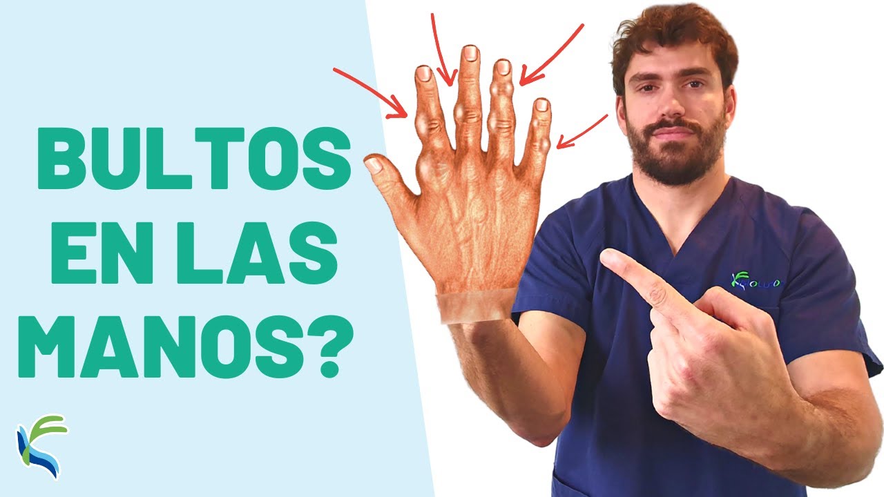 bulto en el dedo de la mano con dolor