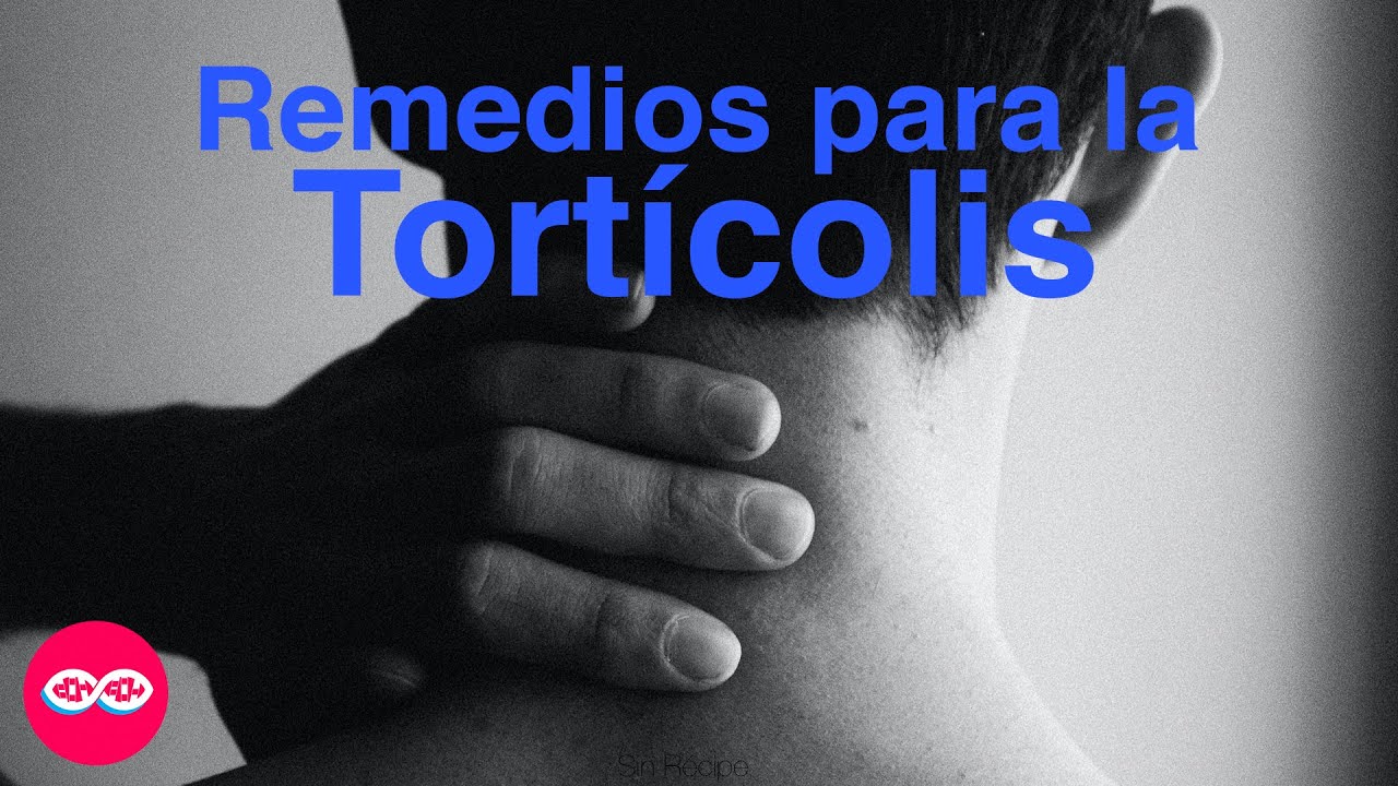 como aliviar la tortícolis de forma natural