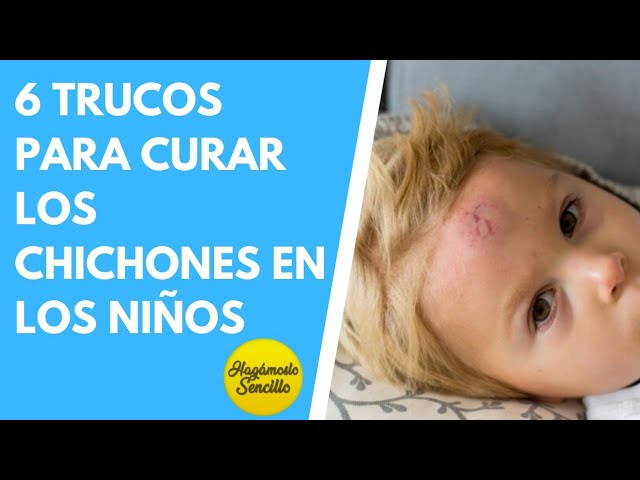 como eliminar un chichon en la cabeza