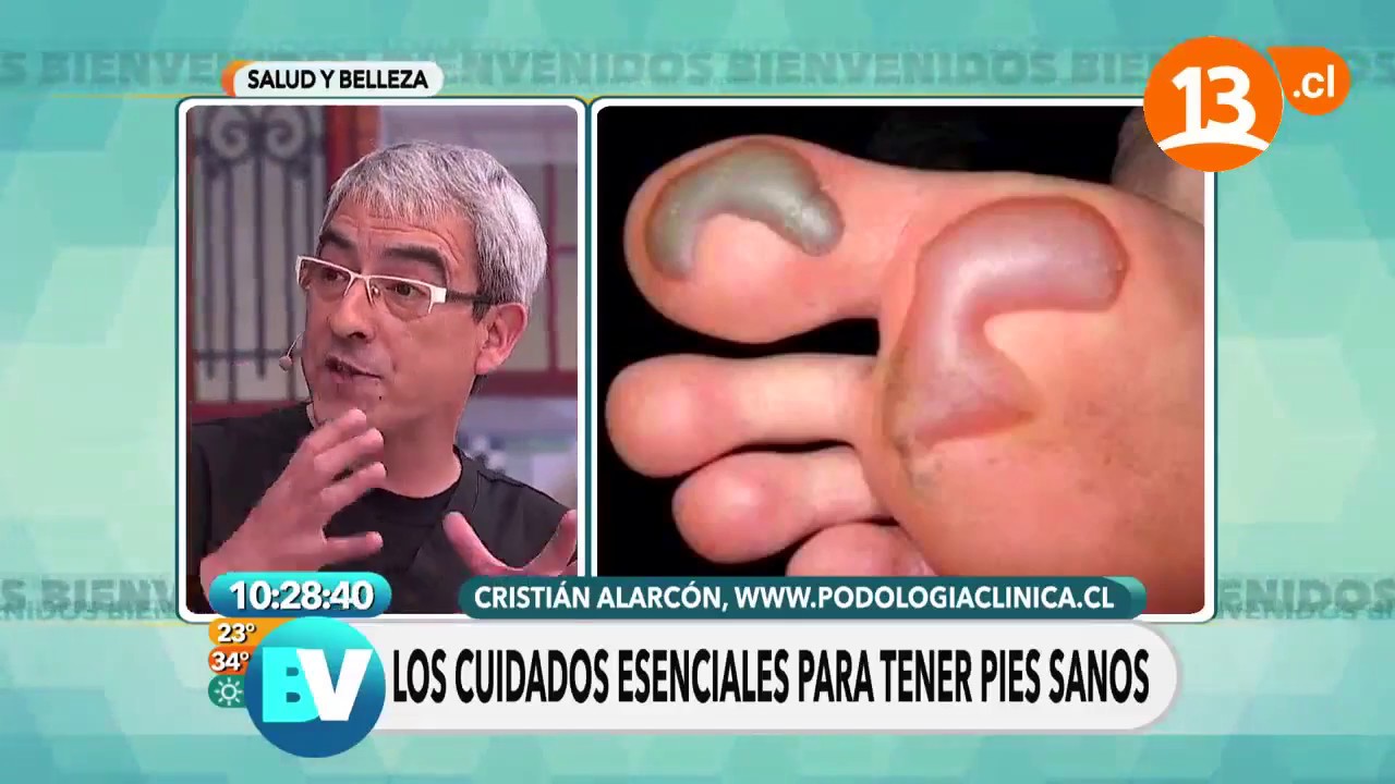 como se curan las llagas de los pies
