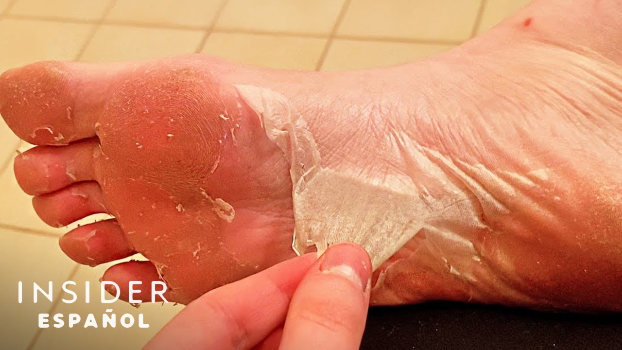 crema para la resequedad de los pies