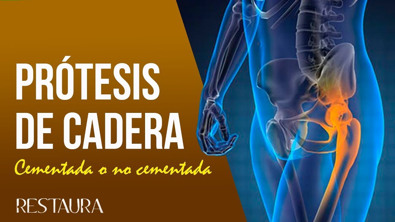diferencia entre protesis de cadera cementada y no cementada