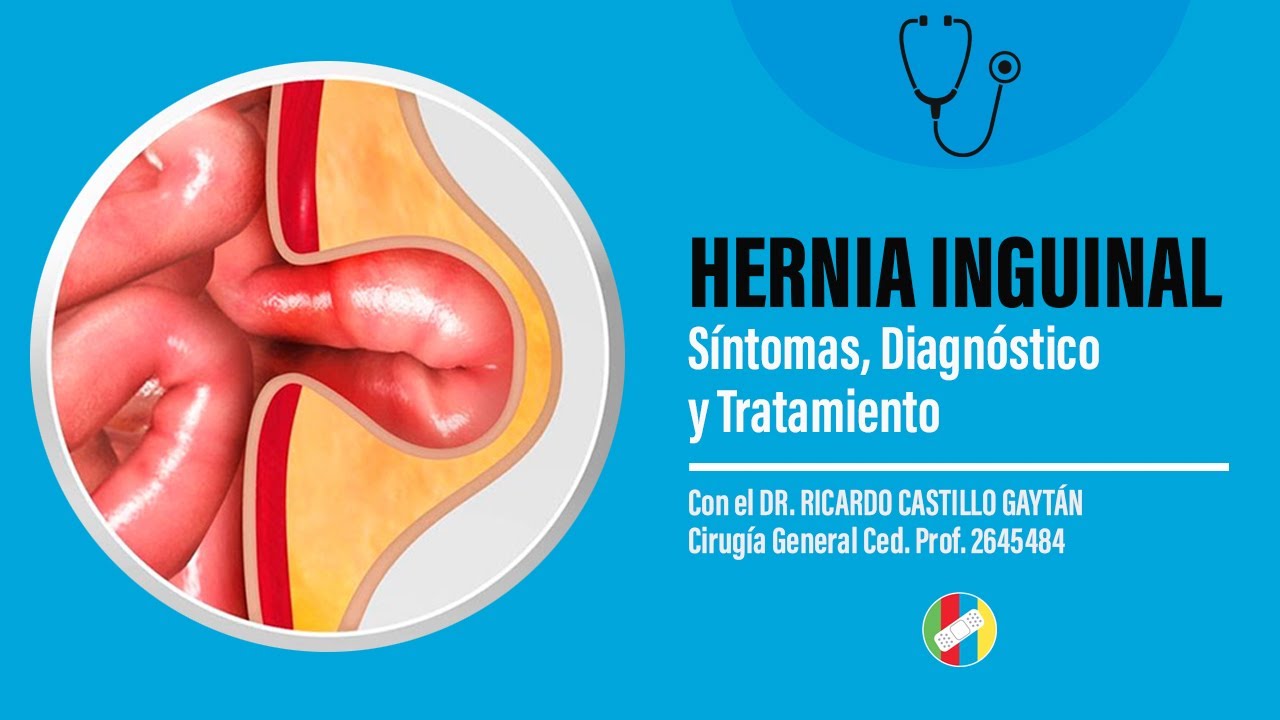 hernia en la ingle mujer sintomas
