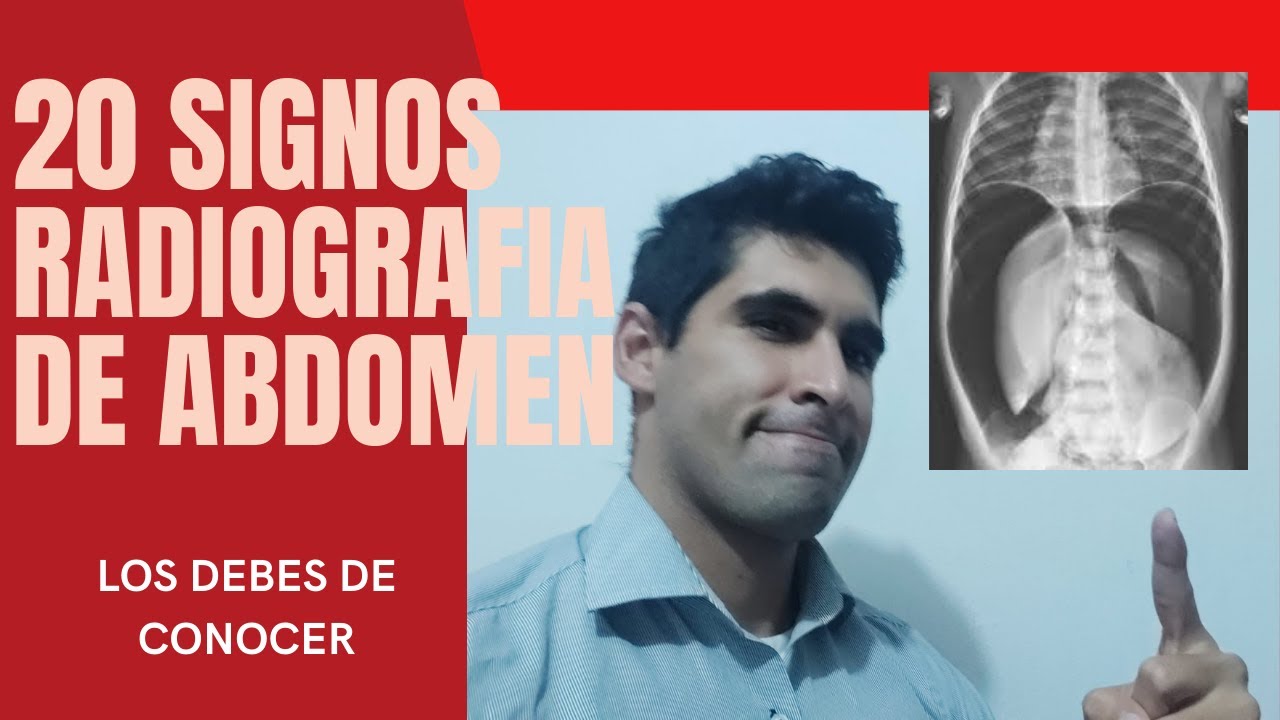 manchas negras en radiografia de abdomen