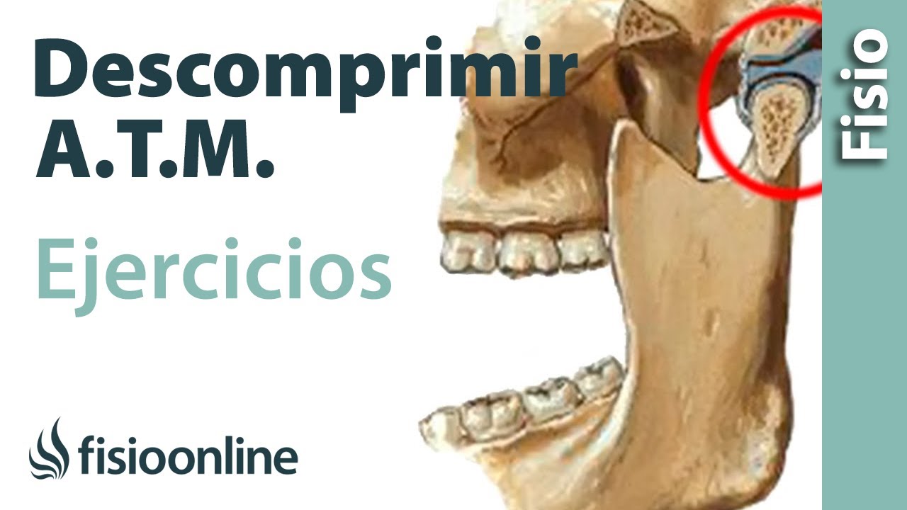 mandibula desencajada y dolor de cabeza
