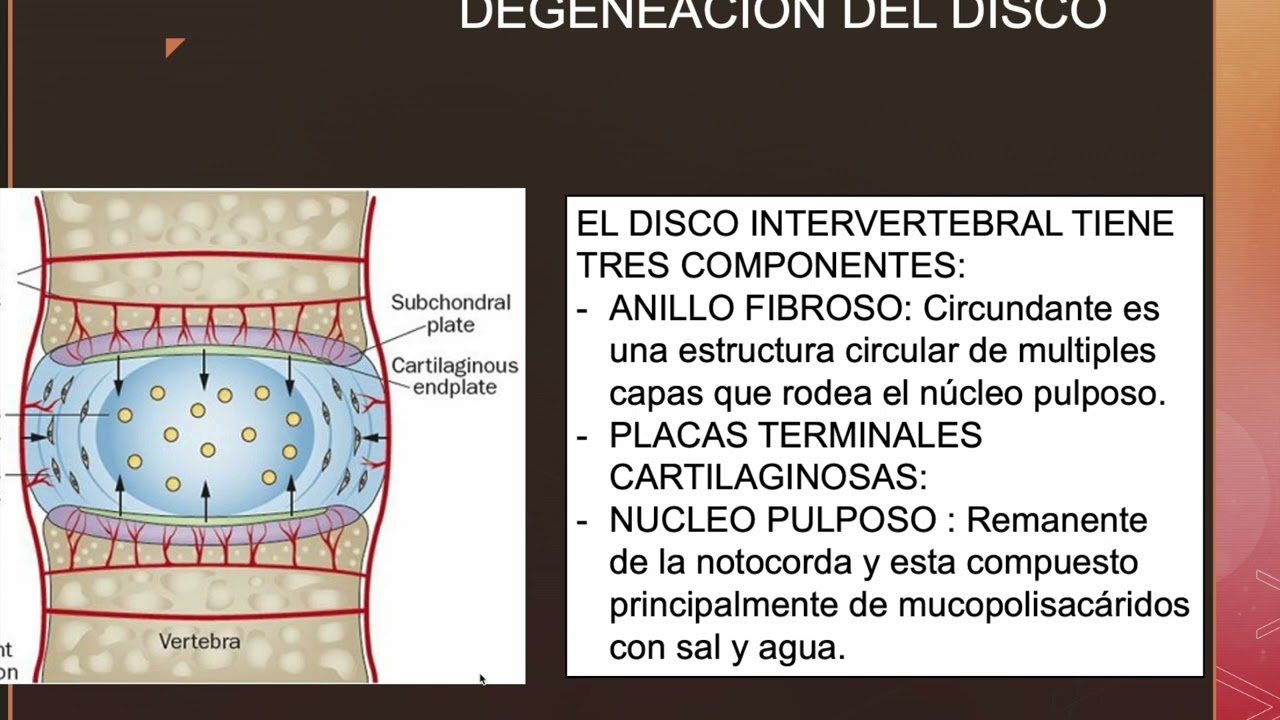 patologias degenerativas de la columna vertebral