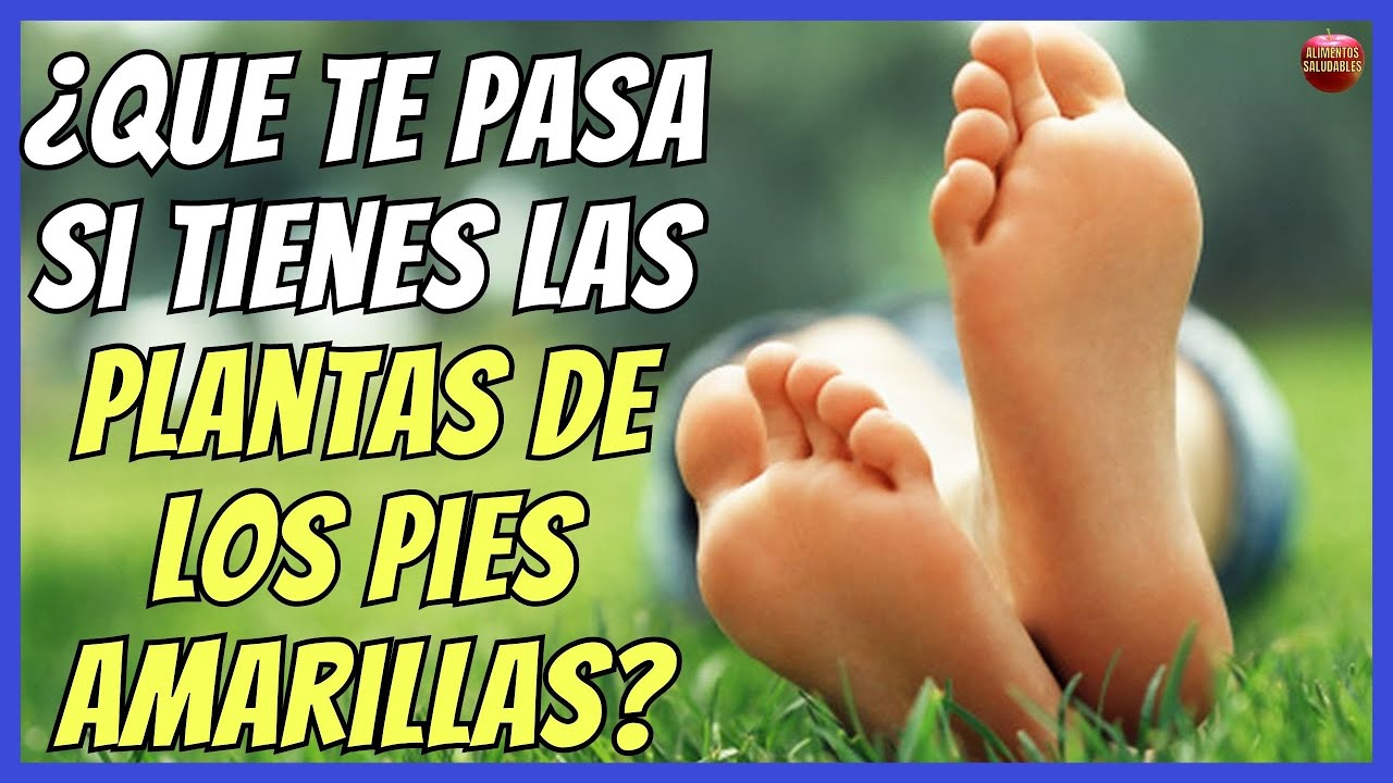 pies amarillos en niños 5 años
