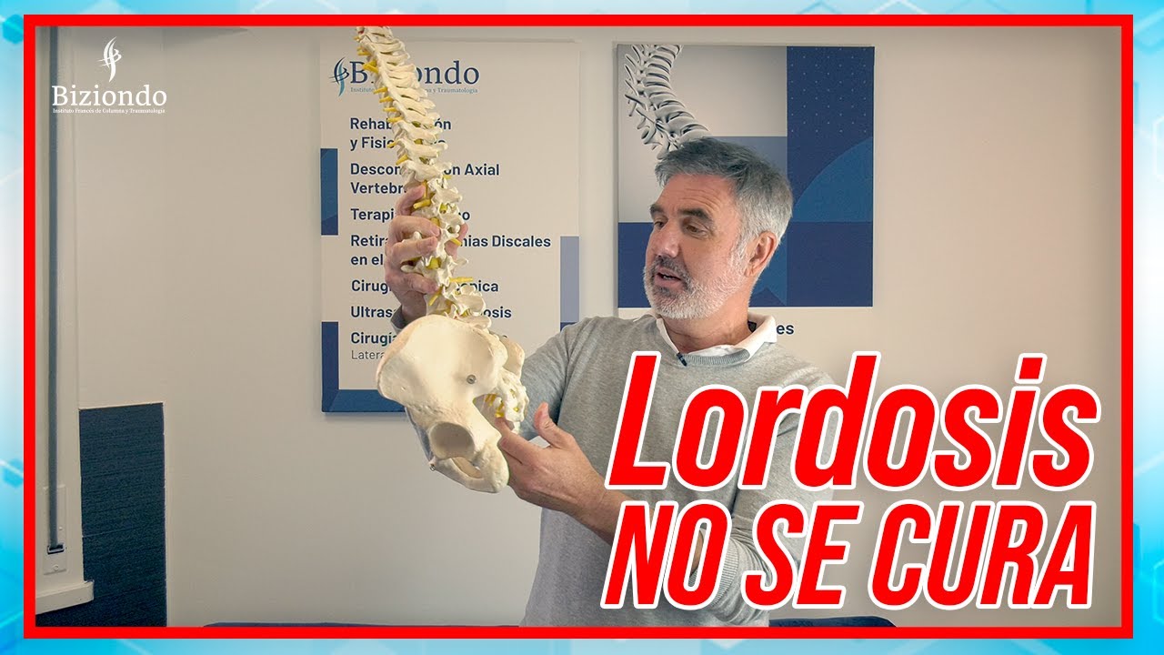 que es rectificacion de la lordosis fisiologica