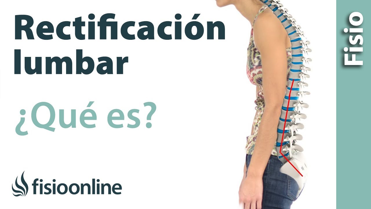 rectificacion de la lordosis lumbar fisiologica