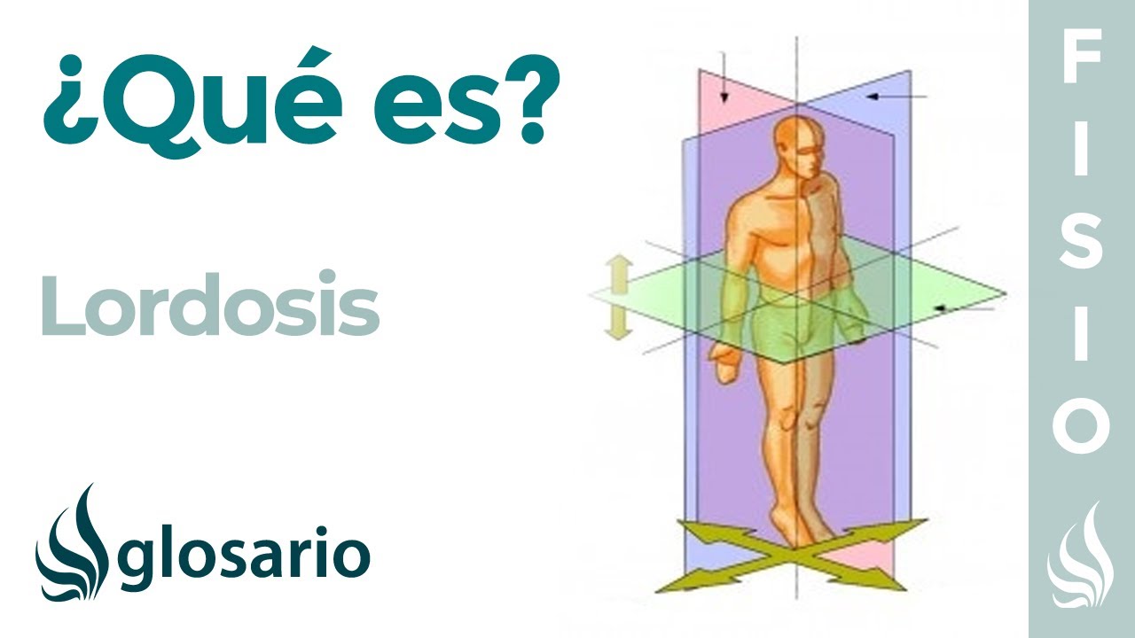 sintomas de la rectificacion de la lordosis cervical