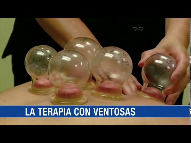 terapia con vasos en la espalda
