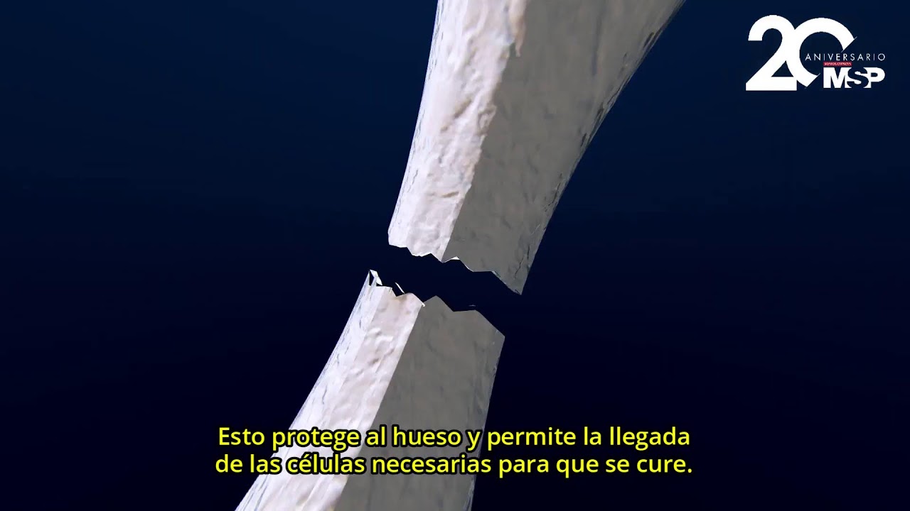 tiempo de soldadura de un hueso