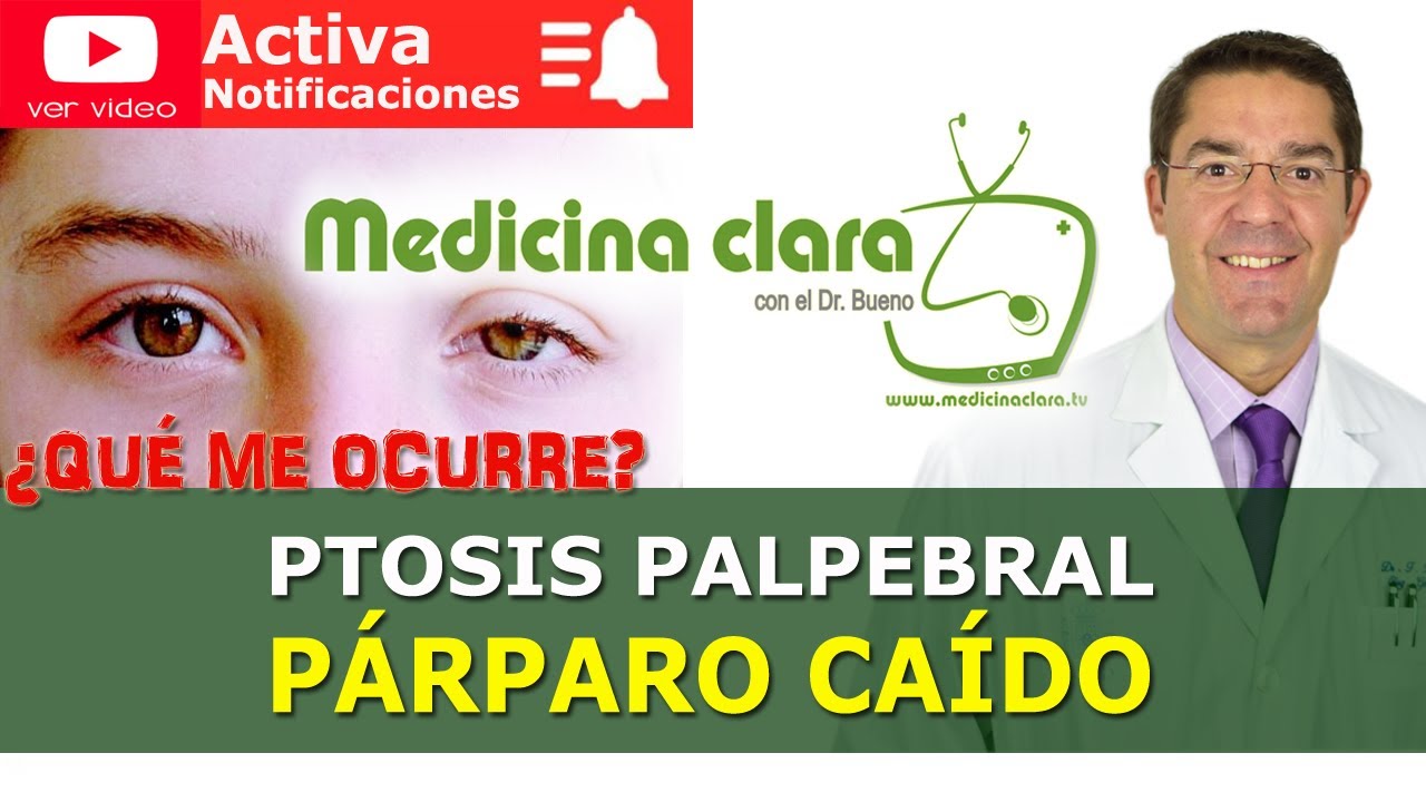 causas de tener un ojo mas grande que otro