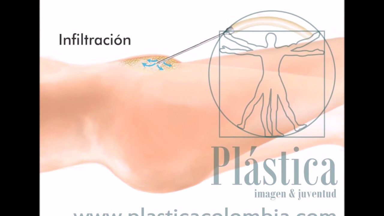 como quitar grasa de la pelvis