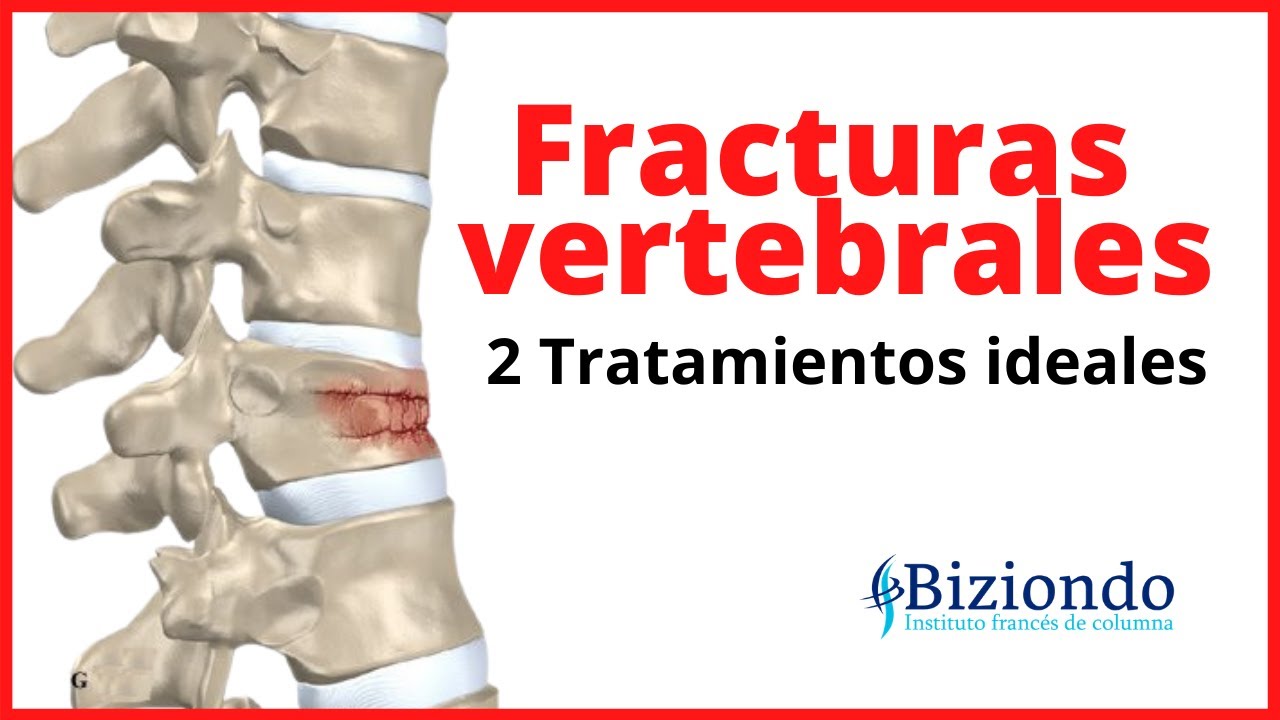 como se cura una fractura de vertebra lumbar