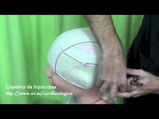 como se llama el vendaje de la cabeza