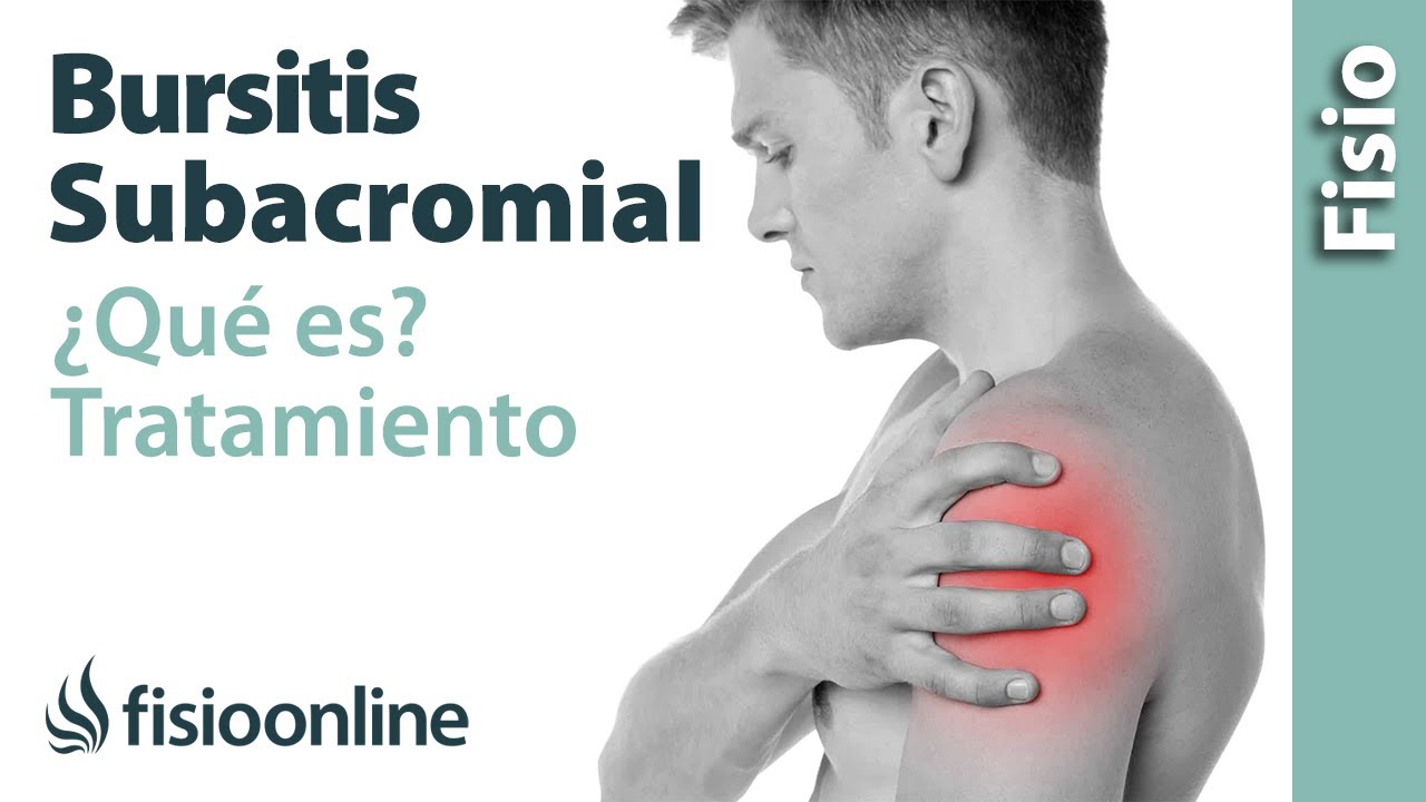 cuanto dura una baja por bursitis