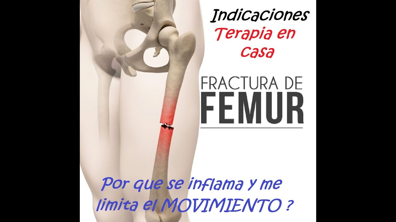 cuánto tarda en recuperarse de una fractura de femur