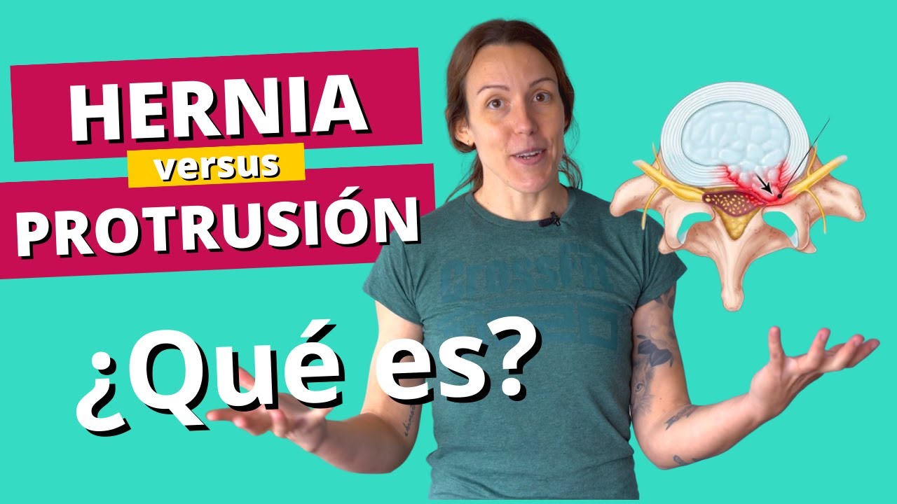 cuanto tiempo tarda en curarse una protusion discal