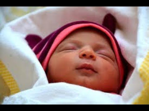 cuantos tipos de sindrome de down existen