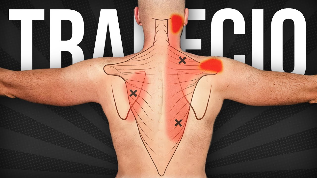 dolor de trapecio cuello y cabeza
