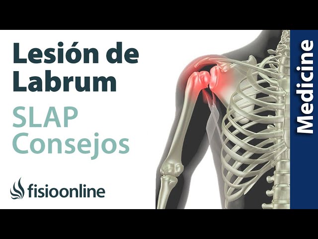dolor en el hombro al lanzar la bola