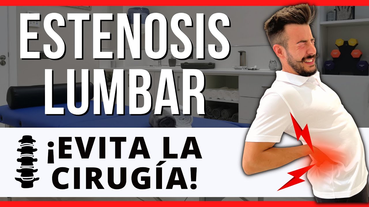 es bueno andar para la estenosis lumbar