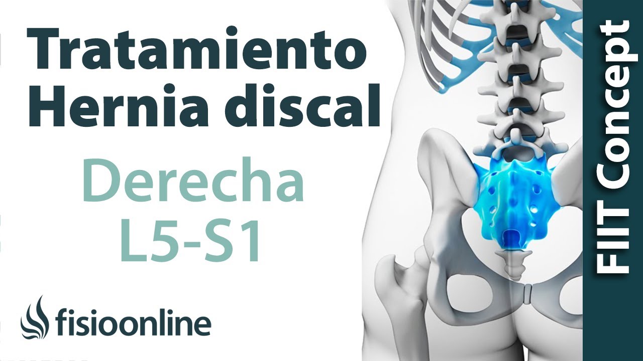 hernia discal l5 s1 se cura