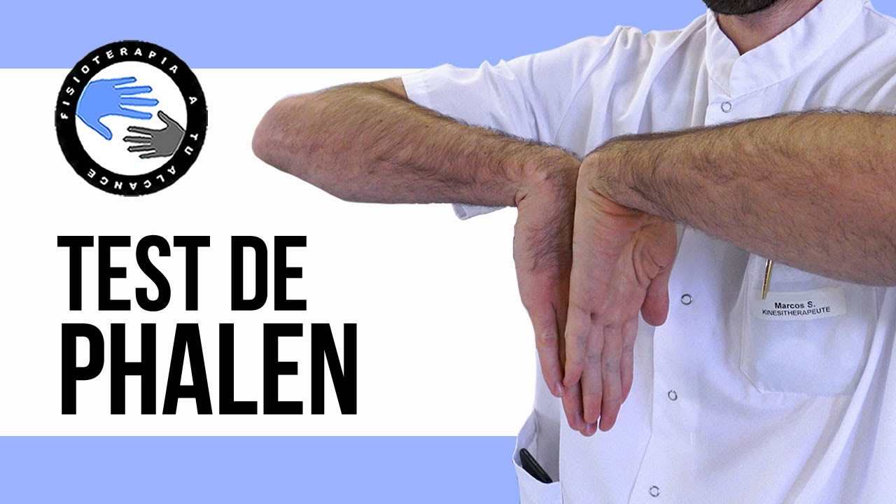 prueba para saber si tienes tunel carpiano