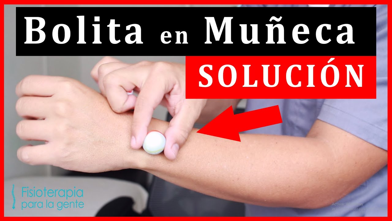 quistes en los tendones de la mano