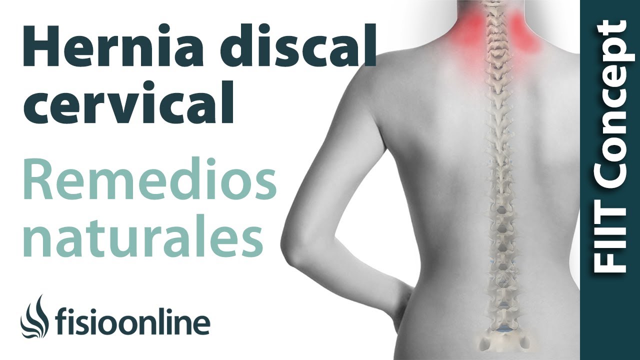 remedios caseros para curar las hernias discales