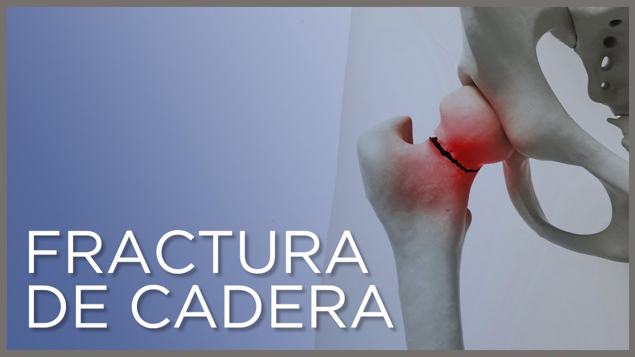 rotura de cadera en ancianos consecuencias