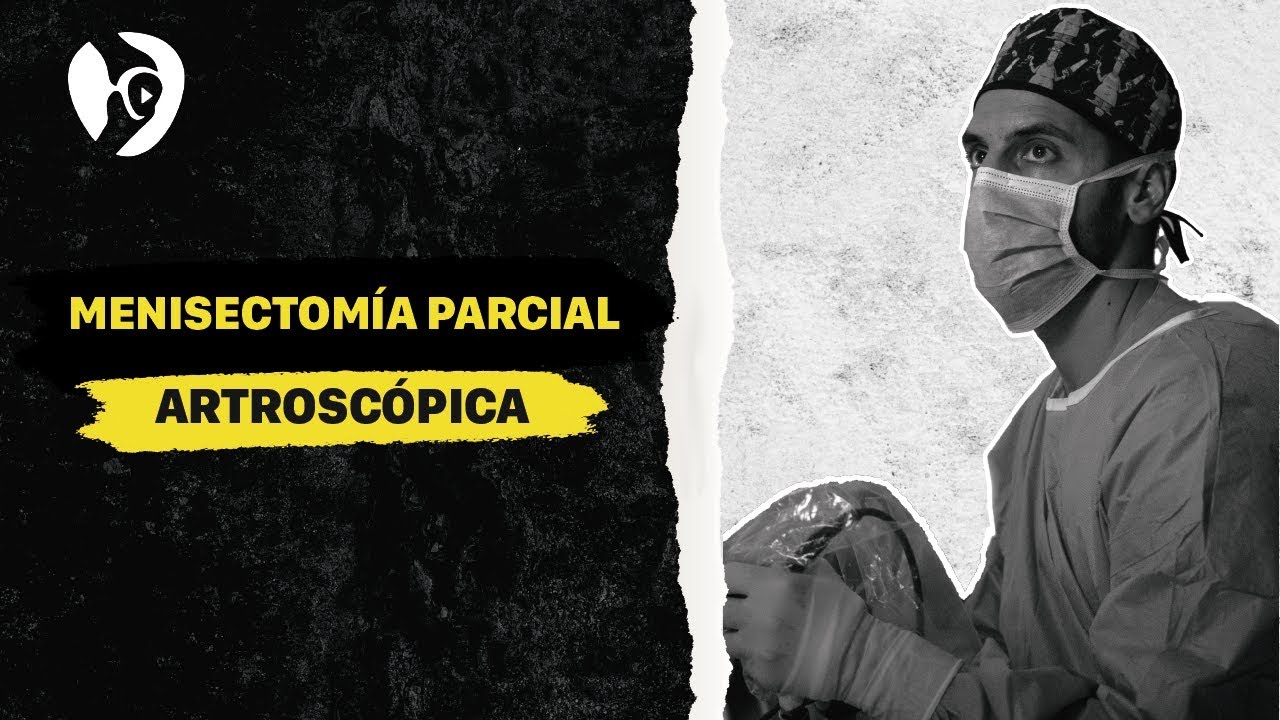 rotura del asta posterior del menisco interno