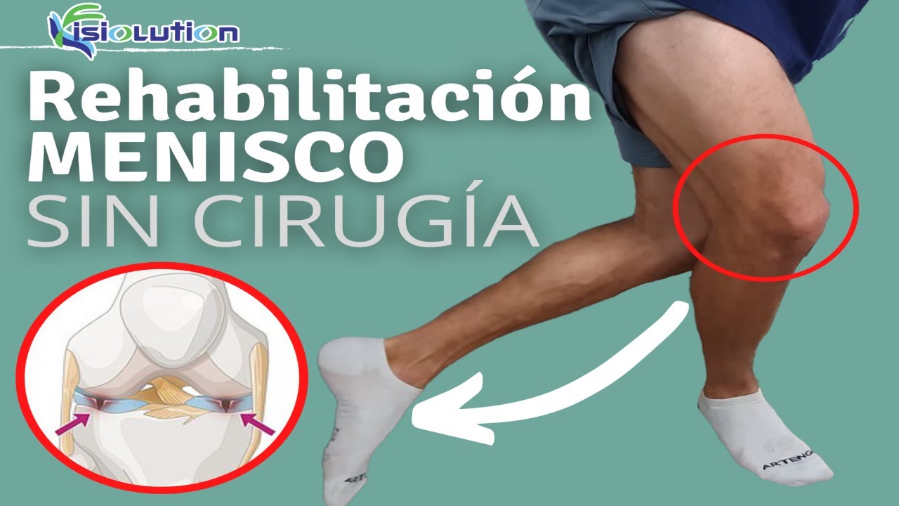 se puede curar un menisco roto sin operacion