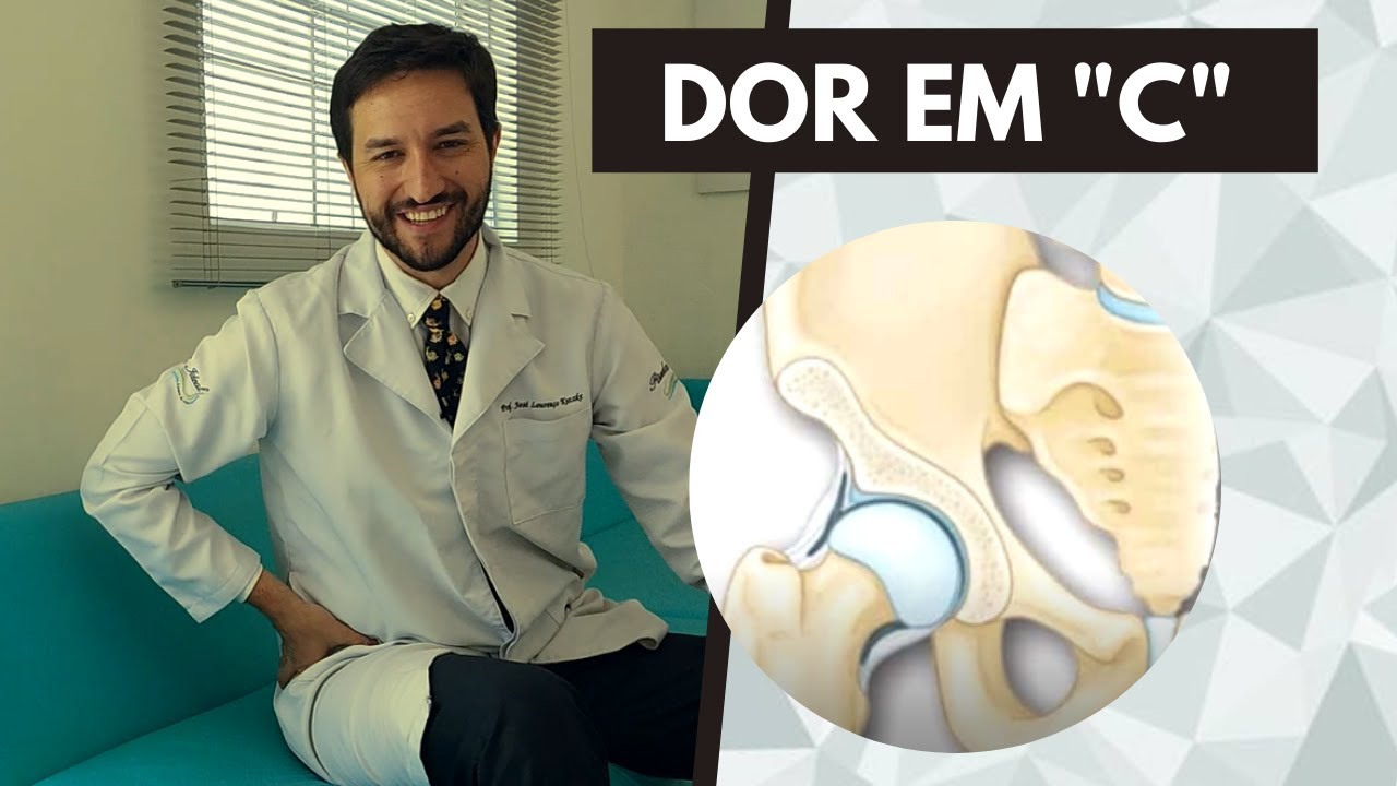 sindrome do impacto femoro acetabular exercicios