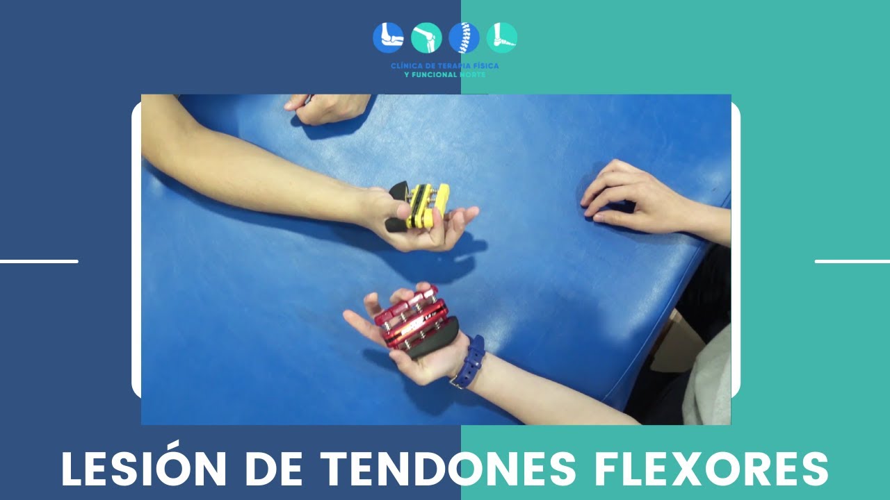 terapia para tendones de la mano