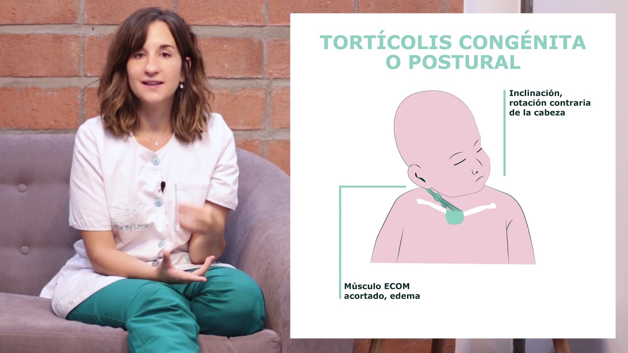 torticolis en niños de 3 a 4 años