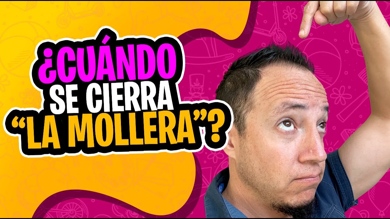a que edad se cierra la fontanela