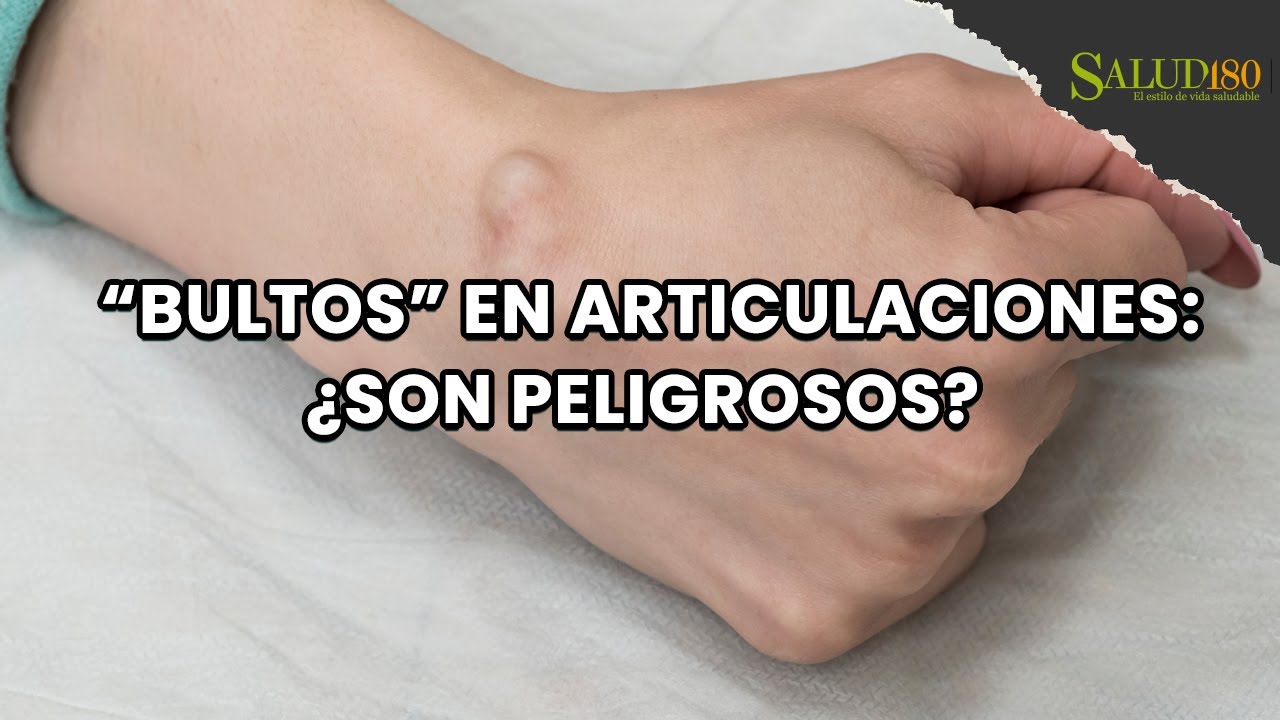 bulto en el dorso de la mano