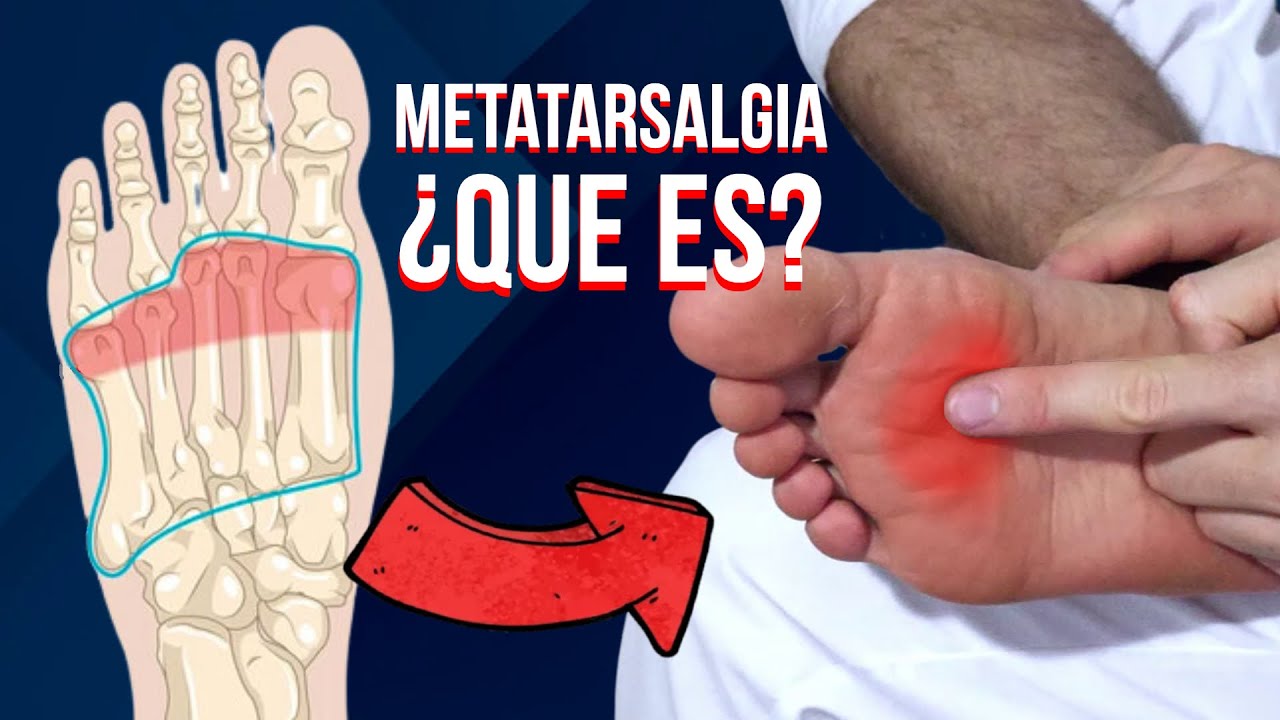 bulto en la planta del pie que duele