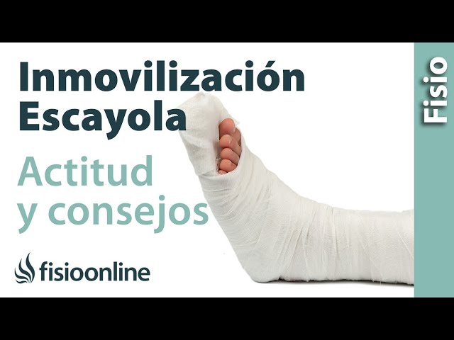 como caminar con yeso en el pie