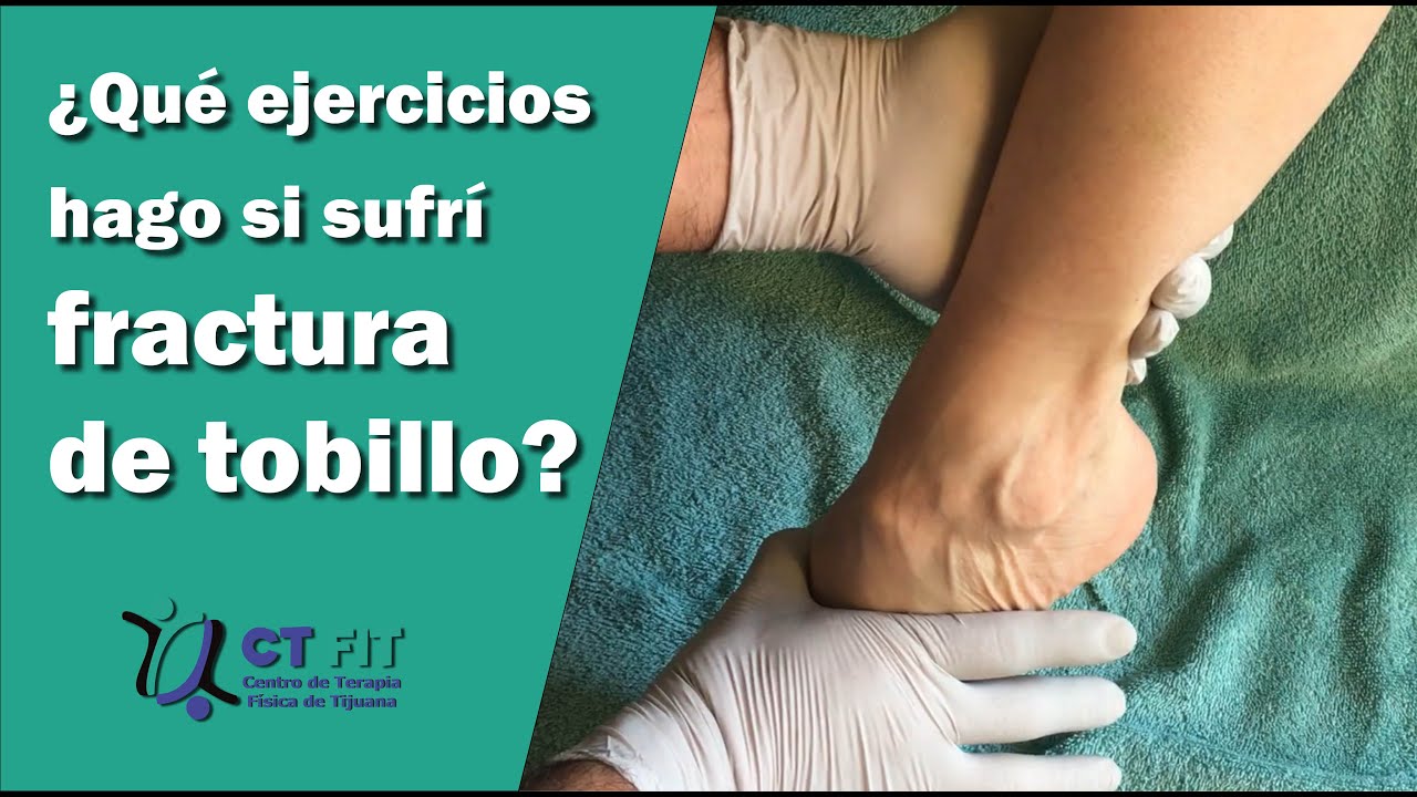 como mantenerse en forma con un tobillo fracturado
