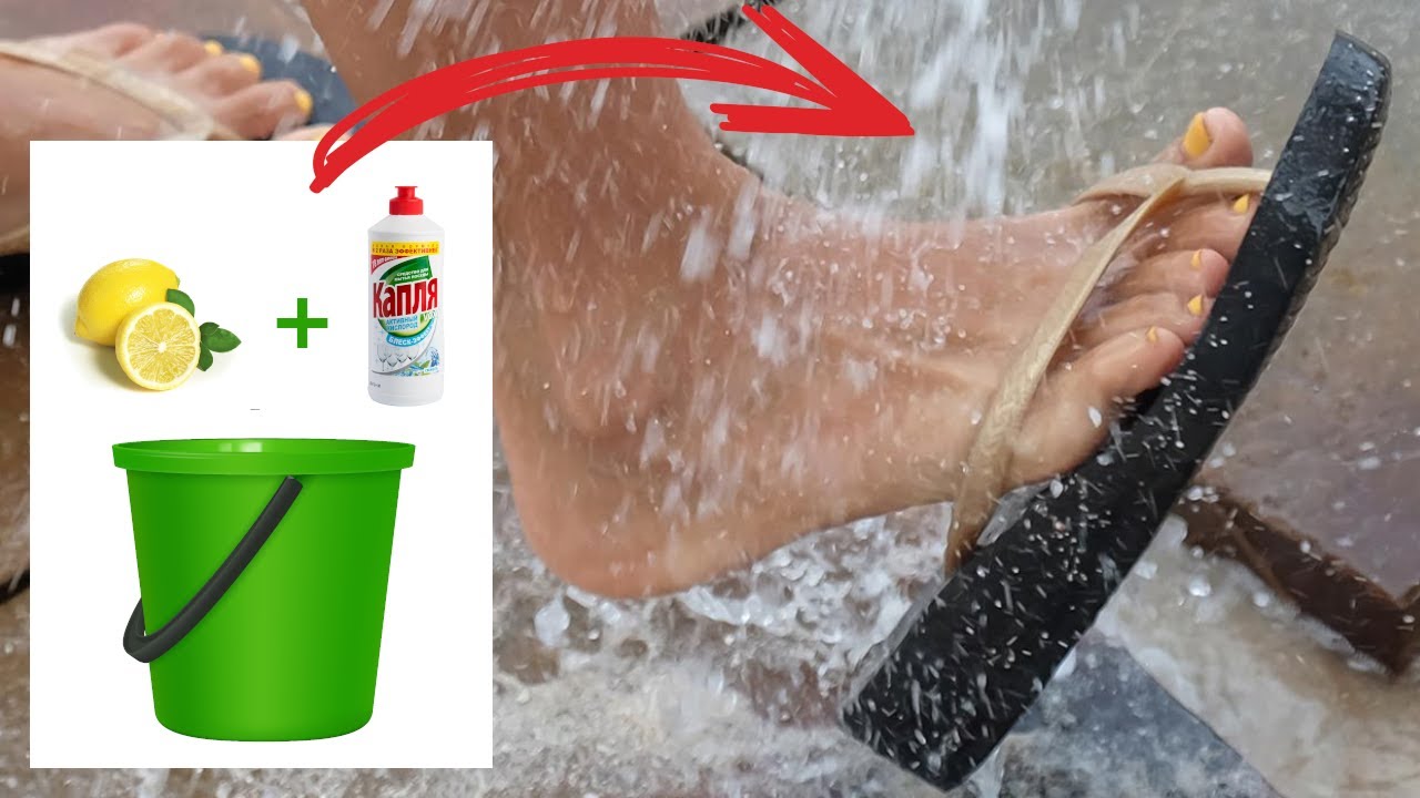 como sacar el olor a pata de las ojotas