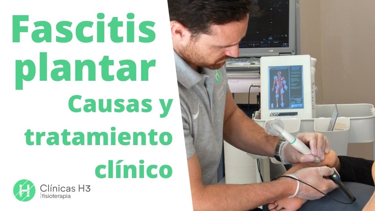 como se cura la fascitis plantar