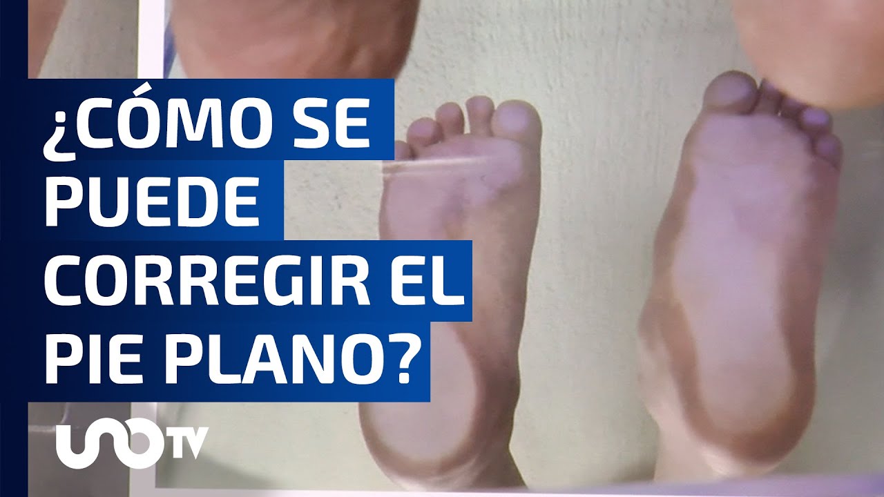 como se llama el doctor de los pies planos
