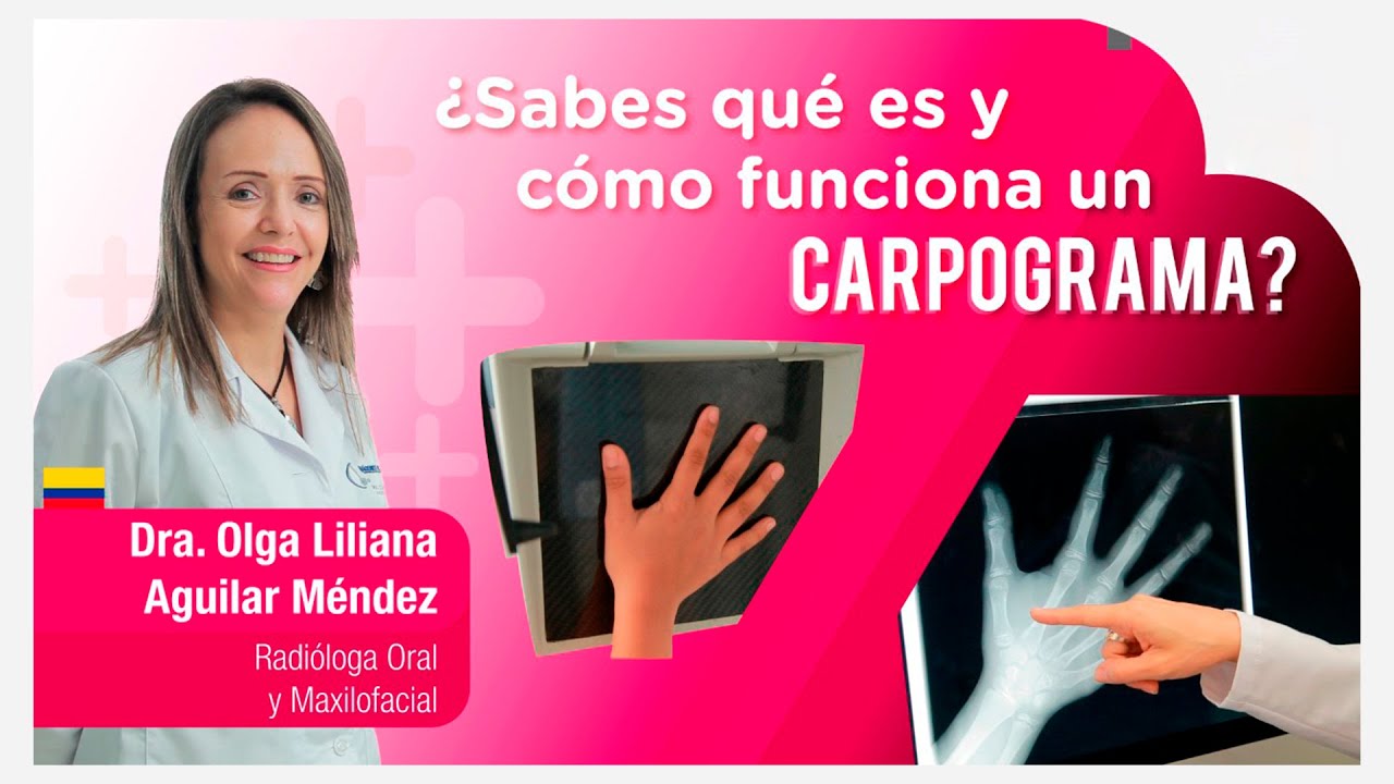 como se ve el cartilago en una radiografia