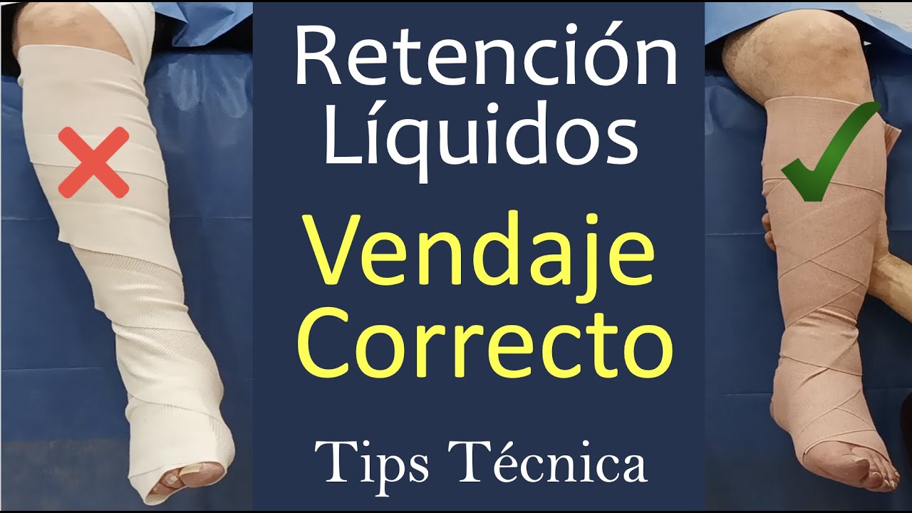 como vendar una pierna con trombosis