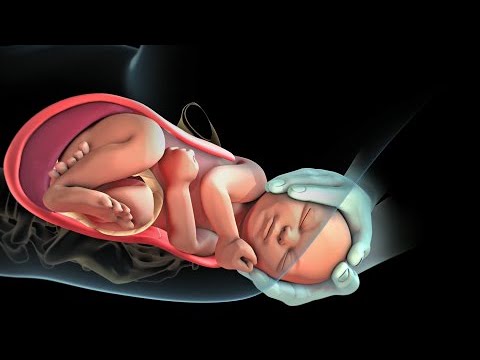 contracciones de parto y movimientos fetales