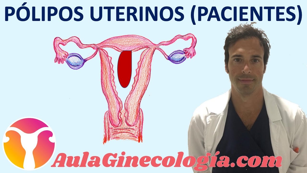 cuidados después de extirpar un pólipo cervical