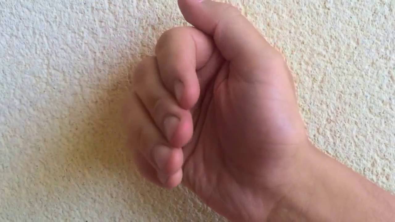 dedo en martillo de la mano